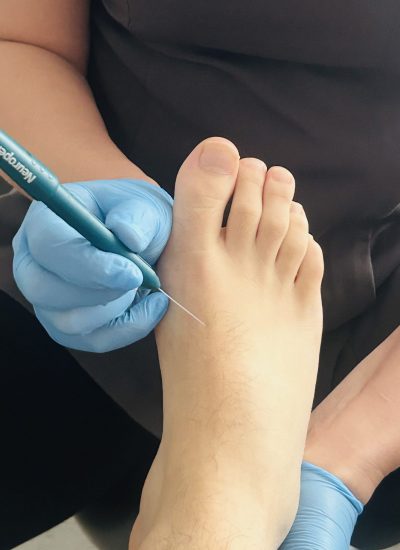 Zoe performing Neurosensory Foot Testing on a client to check for feeling